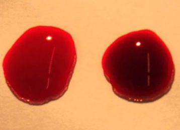 The bright red drop of blood on the left is oxygenated; the one on the right is deoxygenated